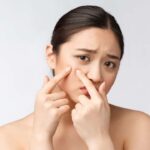 ADVANCED ACNE SKIN FACIAL
