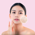 Dry Skin Facial Treatment
