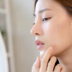 Bad Mood, Bad Skin? Begini Cara Stres Memengaruhi Kesehatan Kulit Anda